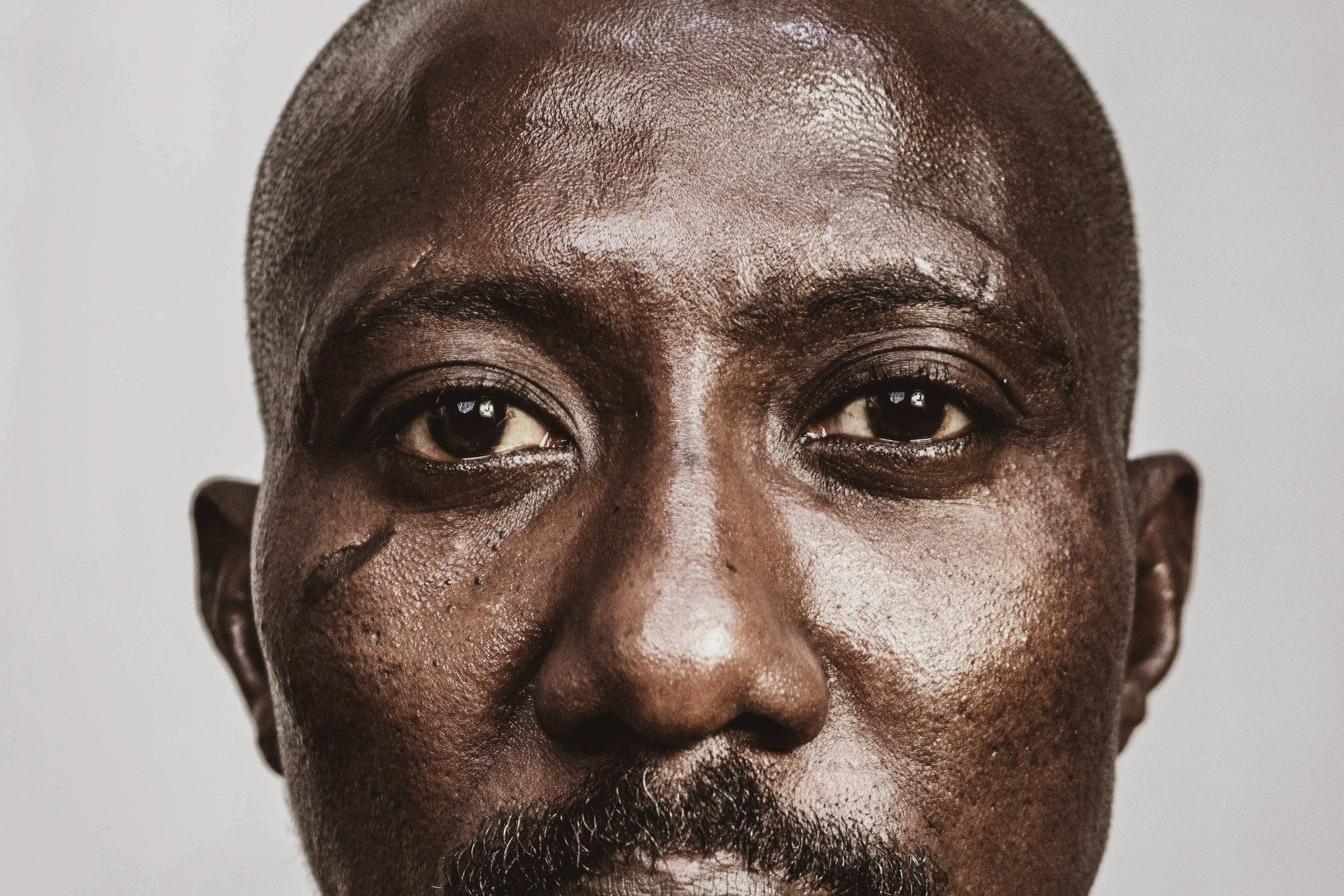 Close-up of a Black man with a scarred cheek.