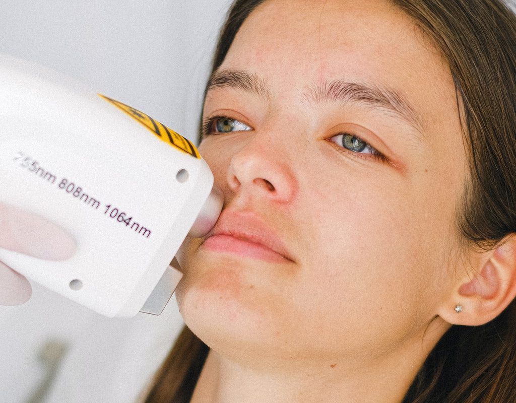 A woman having a laser hair removal treatment on her face.