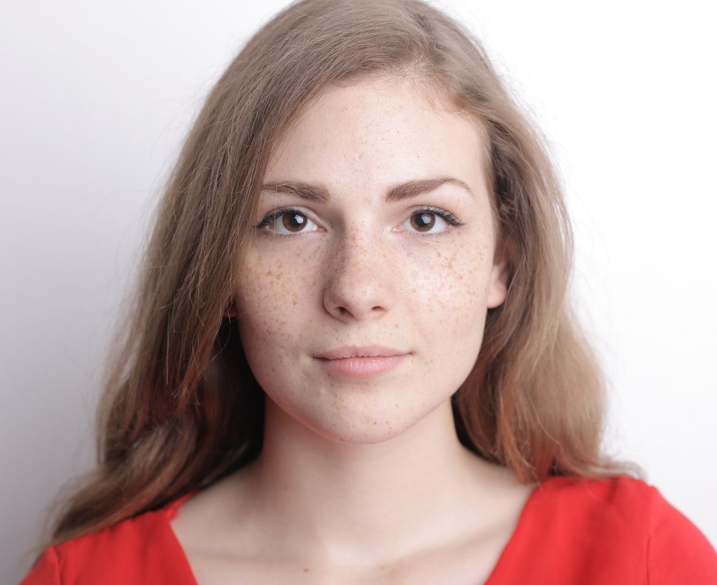 A woman with freckles looking at the camera.