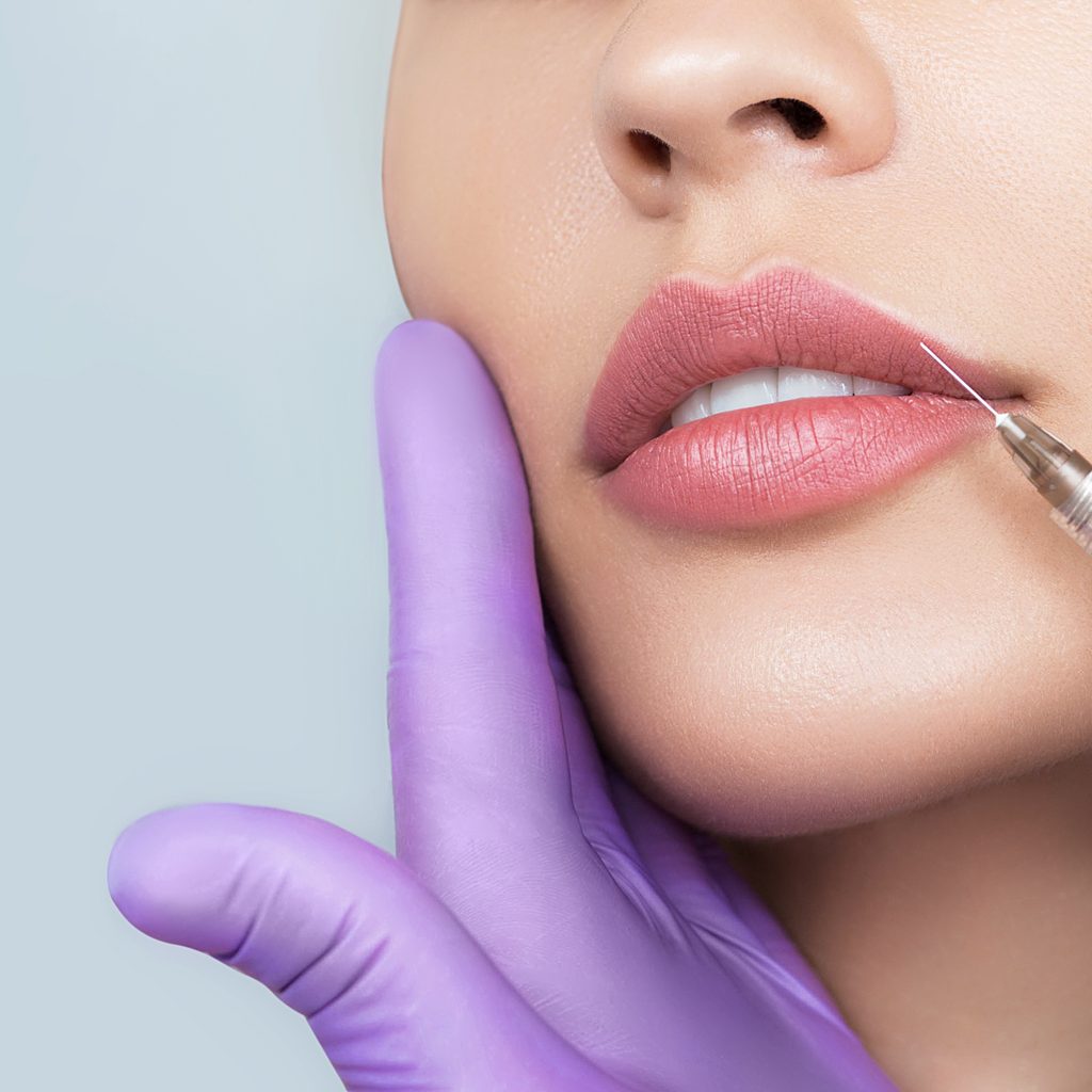 Woman getting syringe of lip filler