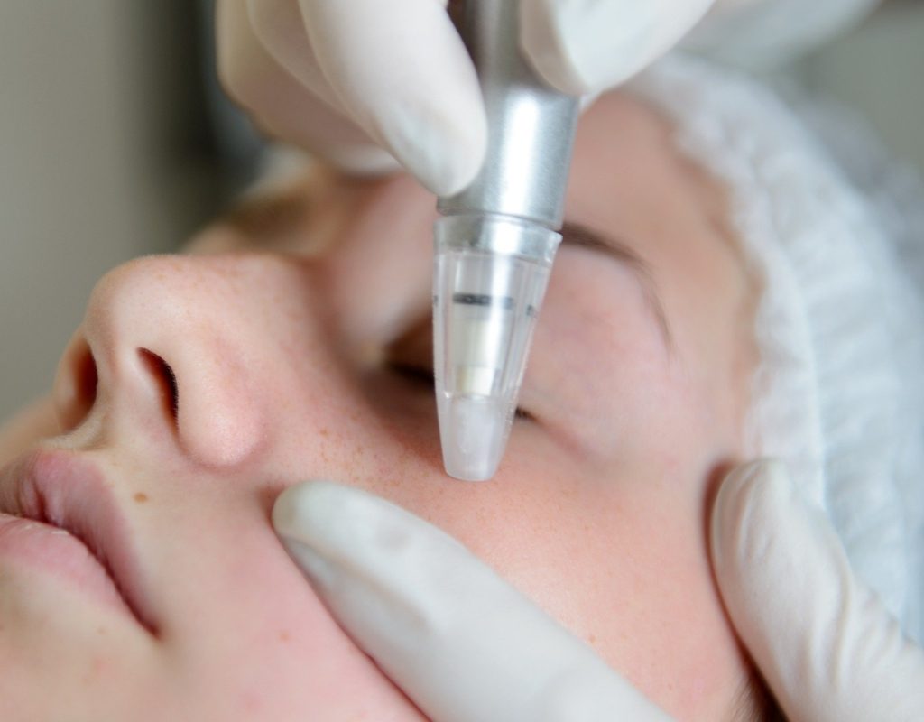 person receiving microdermabrasion procedure
