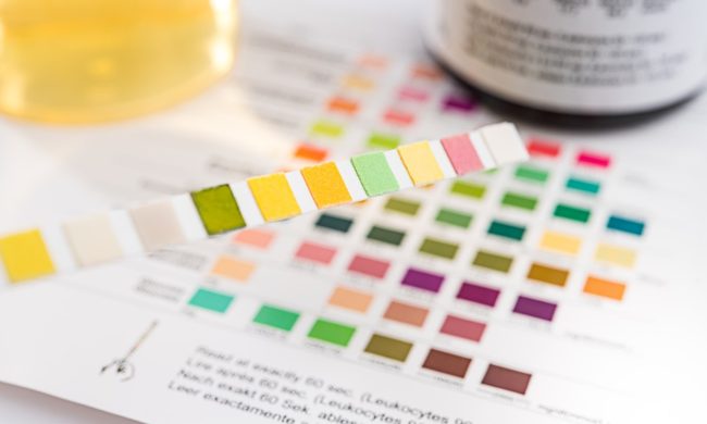 best at-home uti test 2024