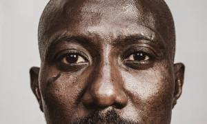 Close-up of a Black man with a scarred cheek.