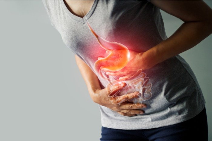 heartburn symptom management stomach woman