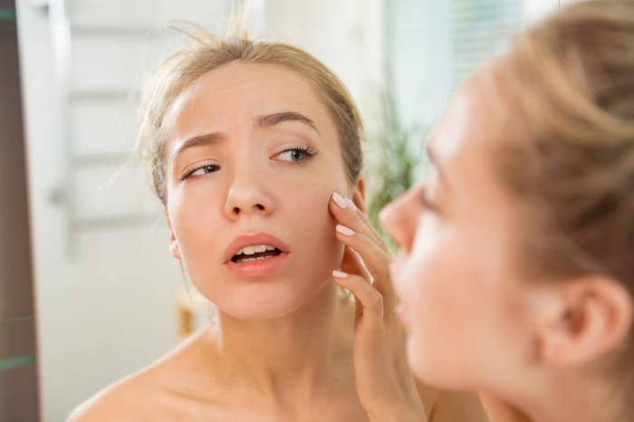 face puffiness remedies woman touching mirror