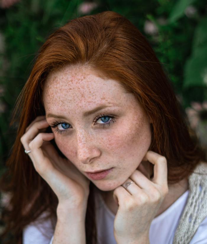 A woman with a lot of freckles looking at the camera.