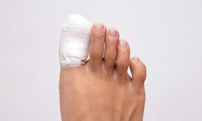 toenail ingrown infection treatment ingrowntoenailhealingbyremovedsomenailb