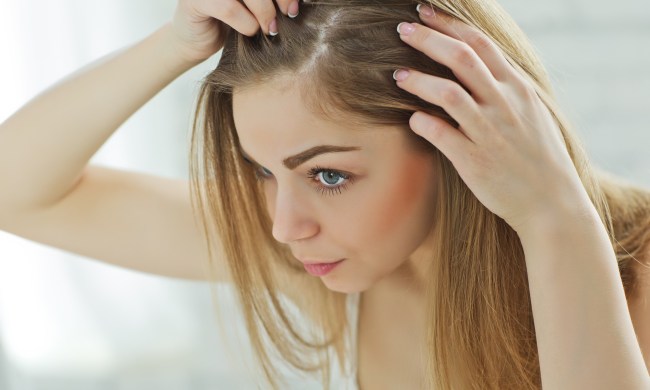 what causes dandruff sad girl looking at her damaged hair