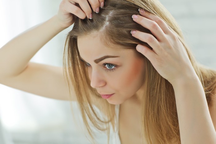 what causes dandruff sad girl looking at her damaged hair