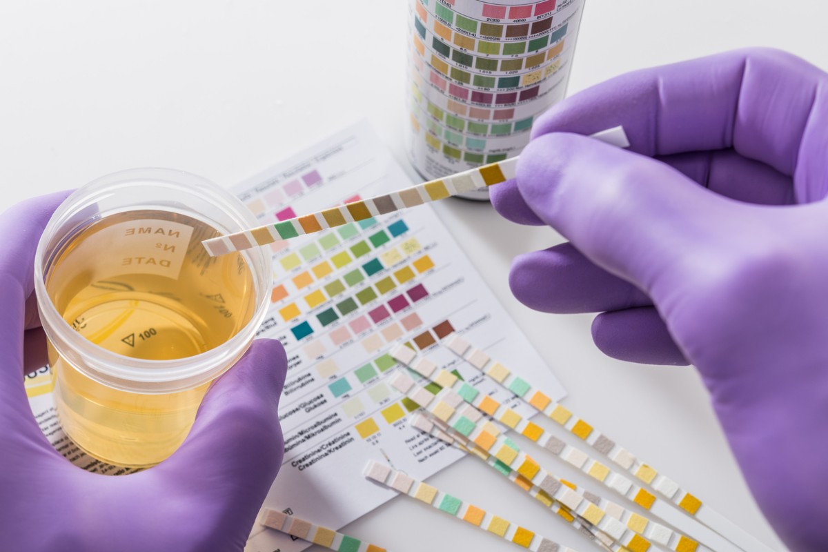 best at-home uti test 2024